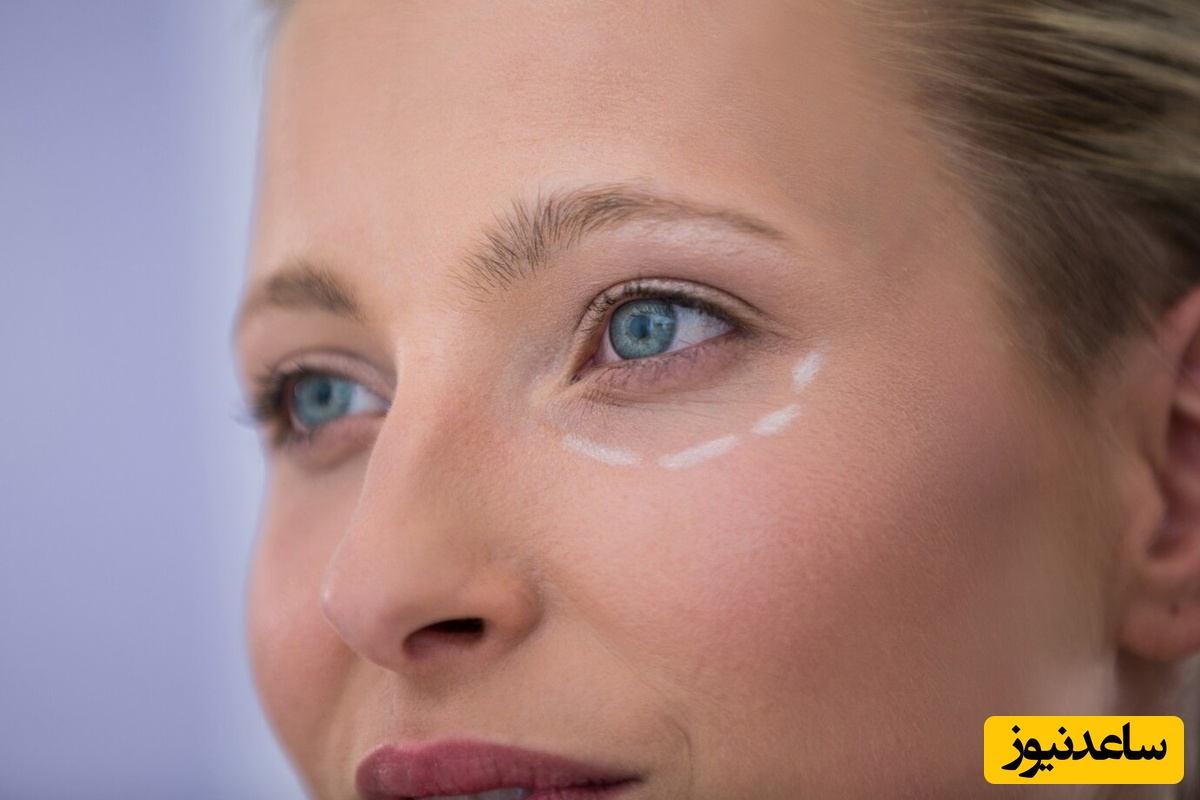 همه چیز درباره پلکسر؛ از نحوه انجام تا کاربردهای آن