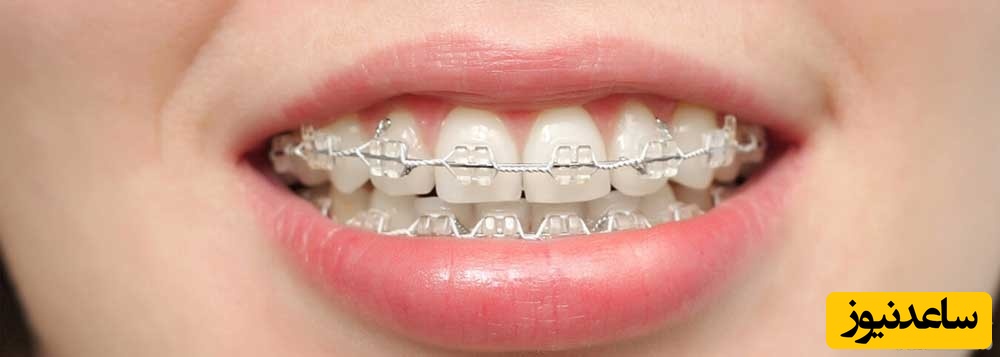 روش کار یک متخصص ارتودنسی چیست؟