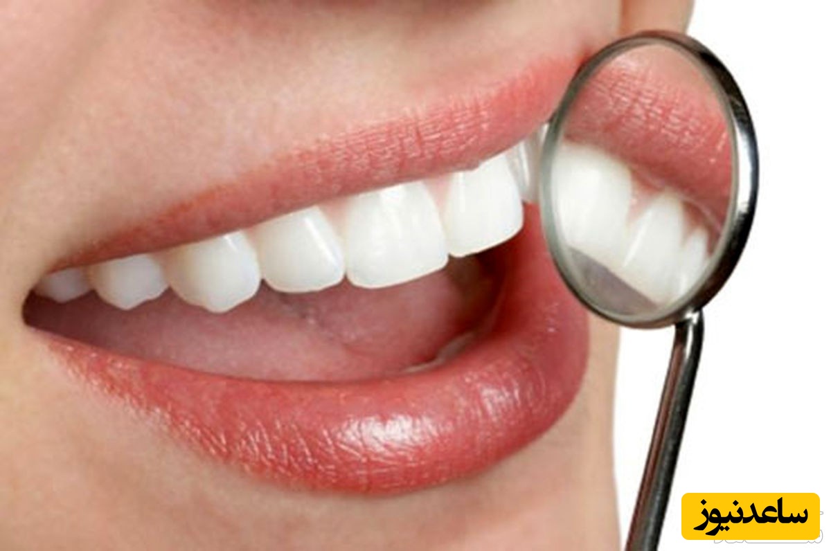 جرم گیری دندان ها با سرکه سیب چگونه میباشد؟