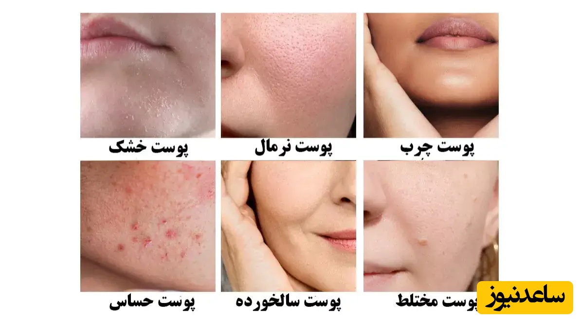 انواع پوست