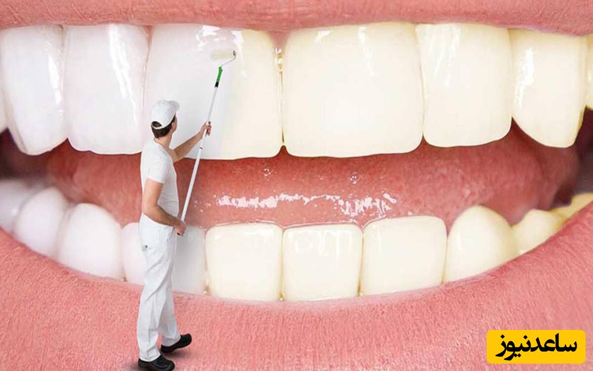 10 روش ارزان و سه سوته برای سفید کردن دندان‌ها با کم هزینه ترین مواد در خانه/ دونستن این ترکیب از نون شب هم واجب تره👌