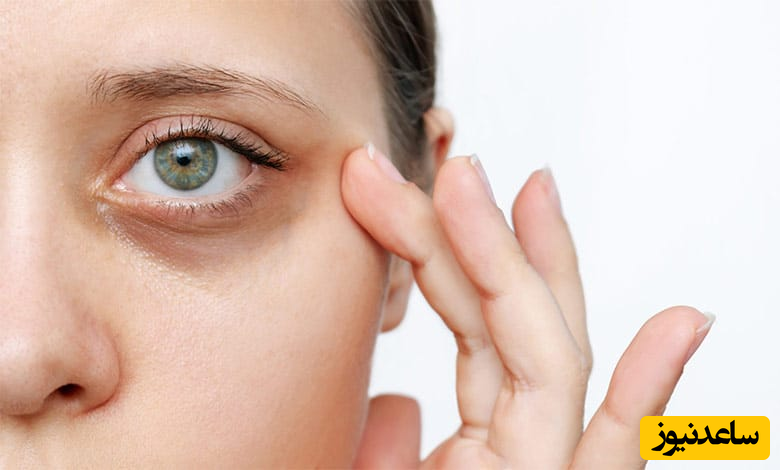 ویتامین های مناسب پوست دور چشم