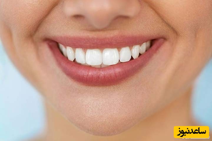 اصلاح طرح لبخند چگونه انجام می گیرد؟