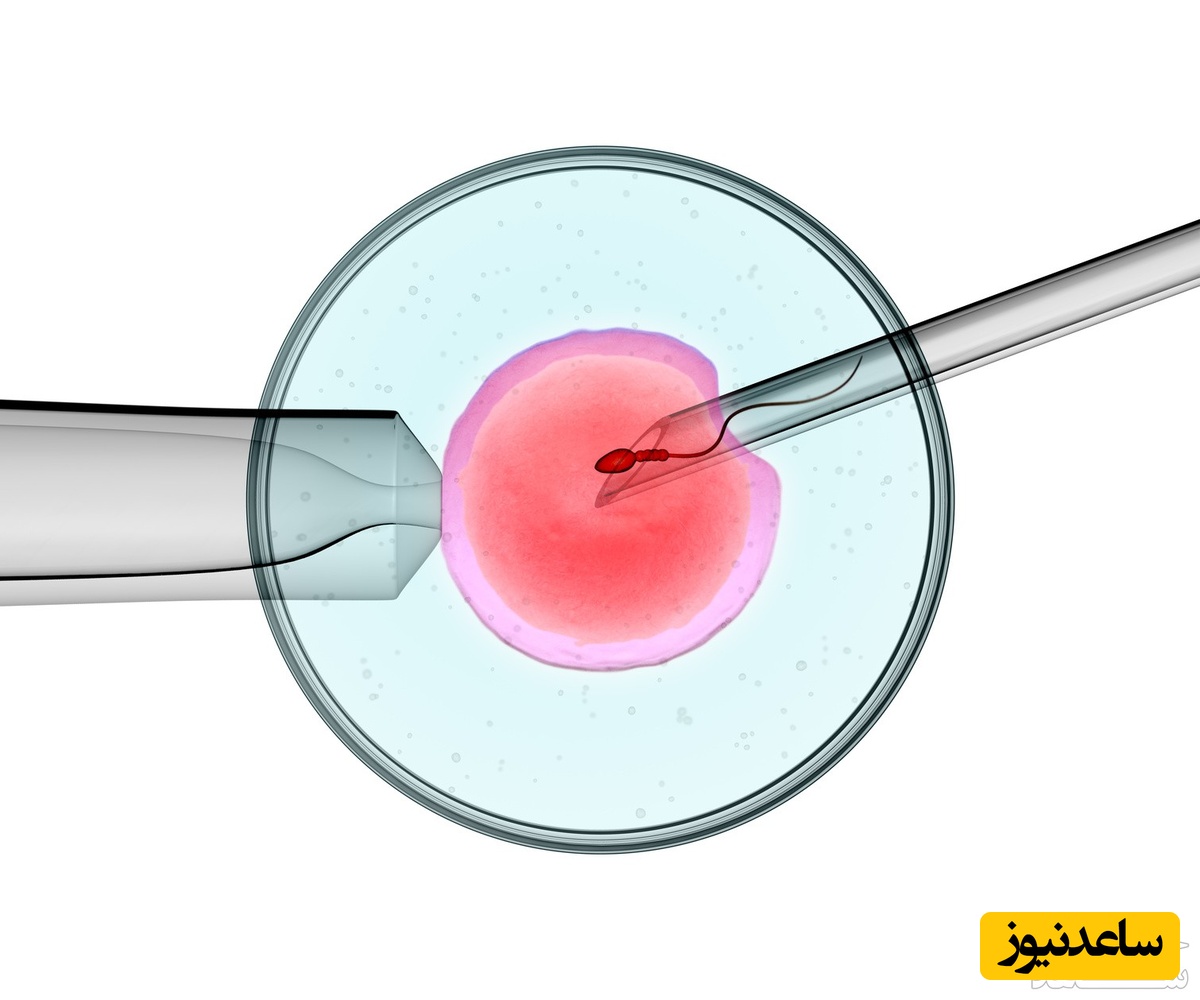 آی وی اف (IVF) با آی یو آی (IUI) چه فرقی دارد؟