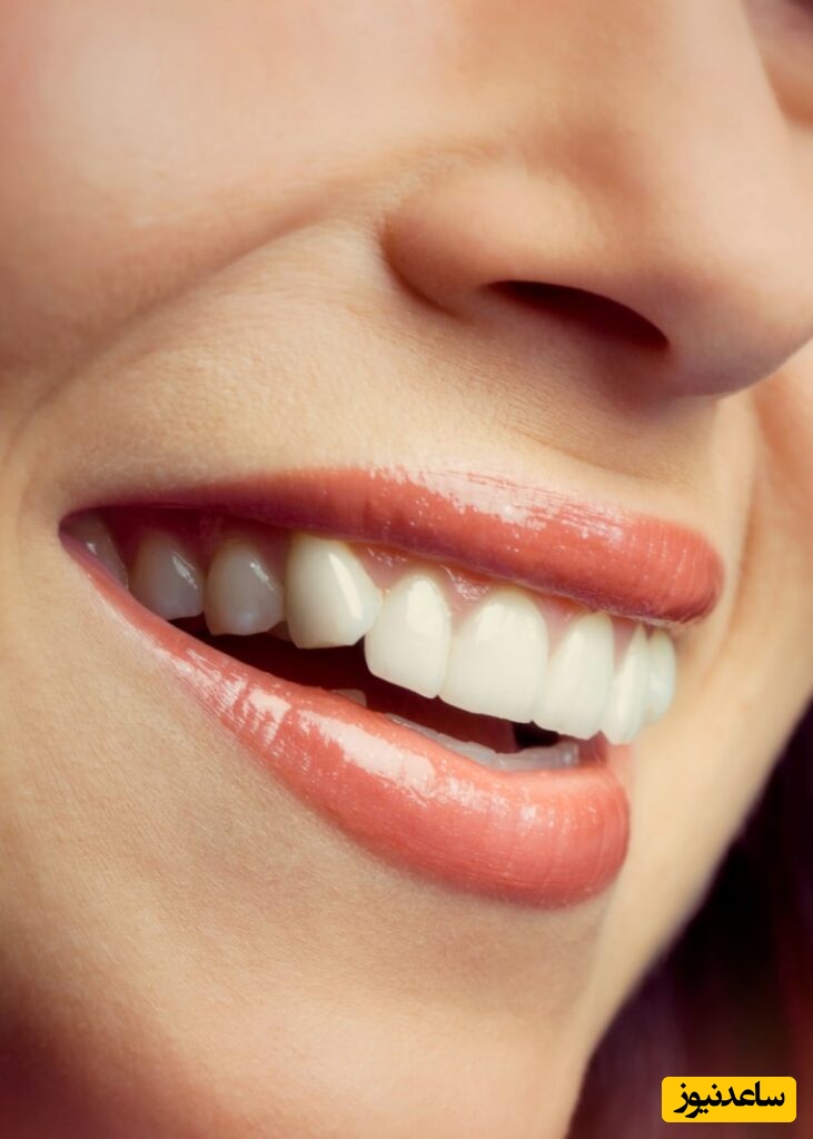 درمان کلینیکی خط لبخند چیست؟