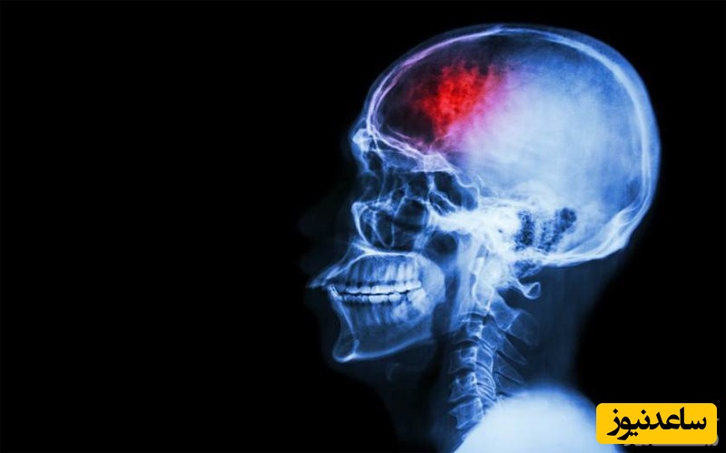 تأثیر ضربه مغزی بر باروری و سلامت زنان