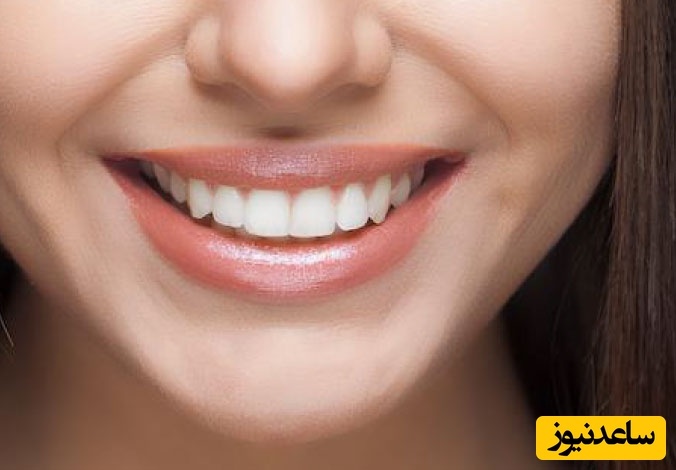 چند نکته که در طرح لبخند باید بدانیم!