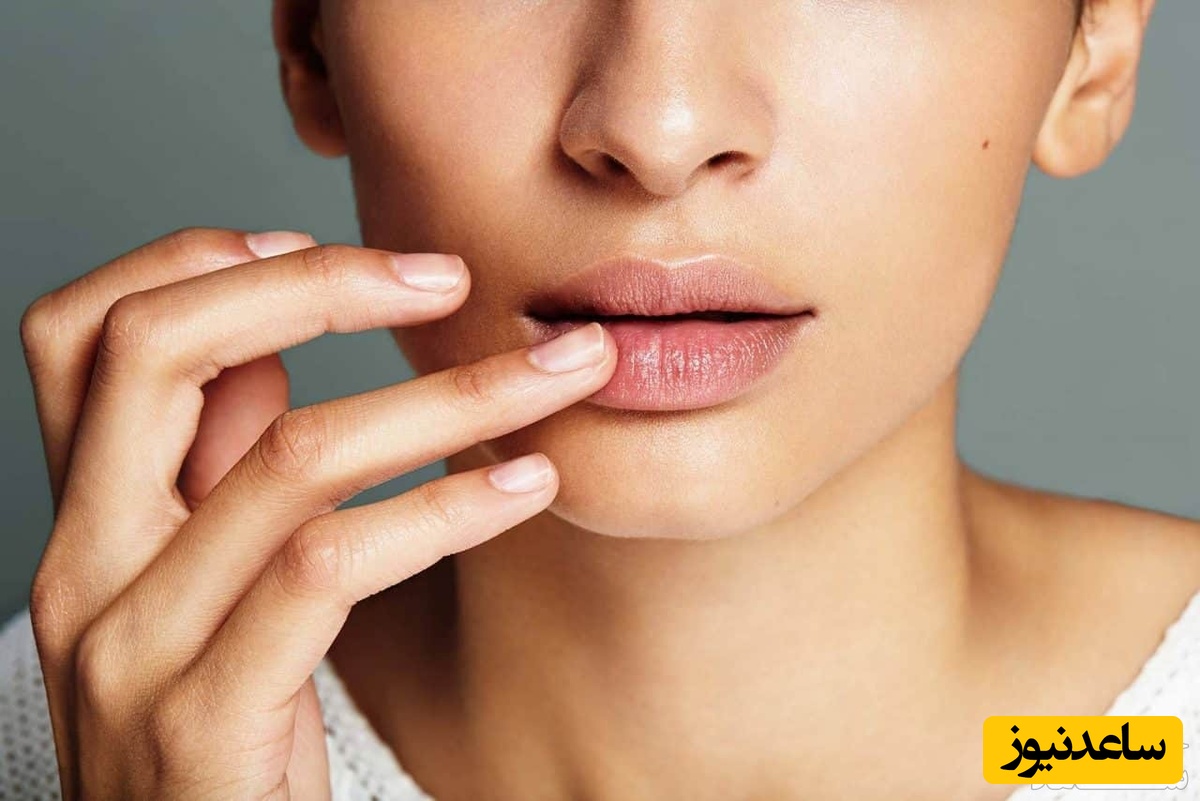 خشکی لب