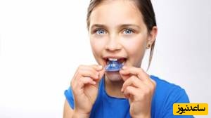 مزایای ارتودنسی فانکشنال چیست؟