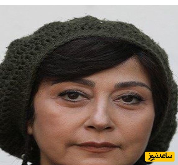 بهناز نازی پس از مدت‌ها مبارزه با سرطان درگذشت