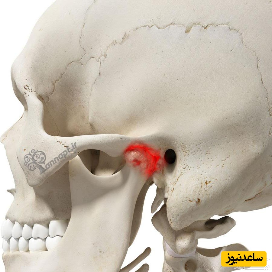 جراحی فک با چه مشکلاتی همراه است؟