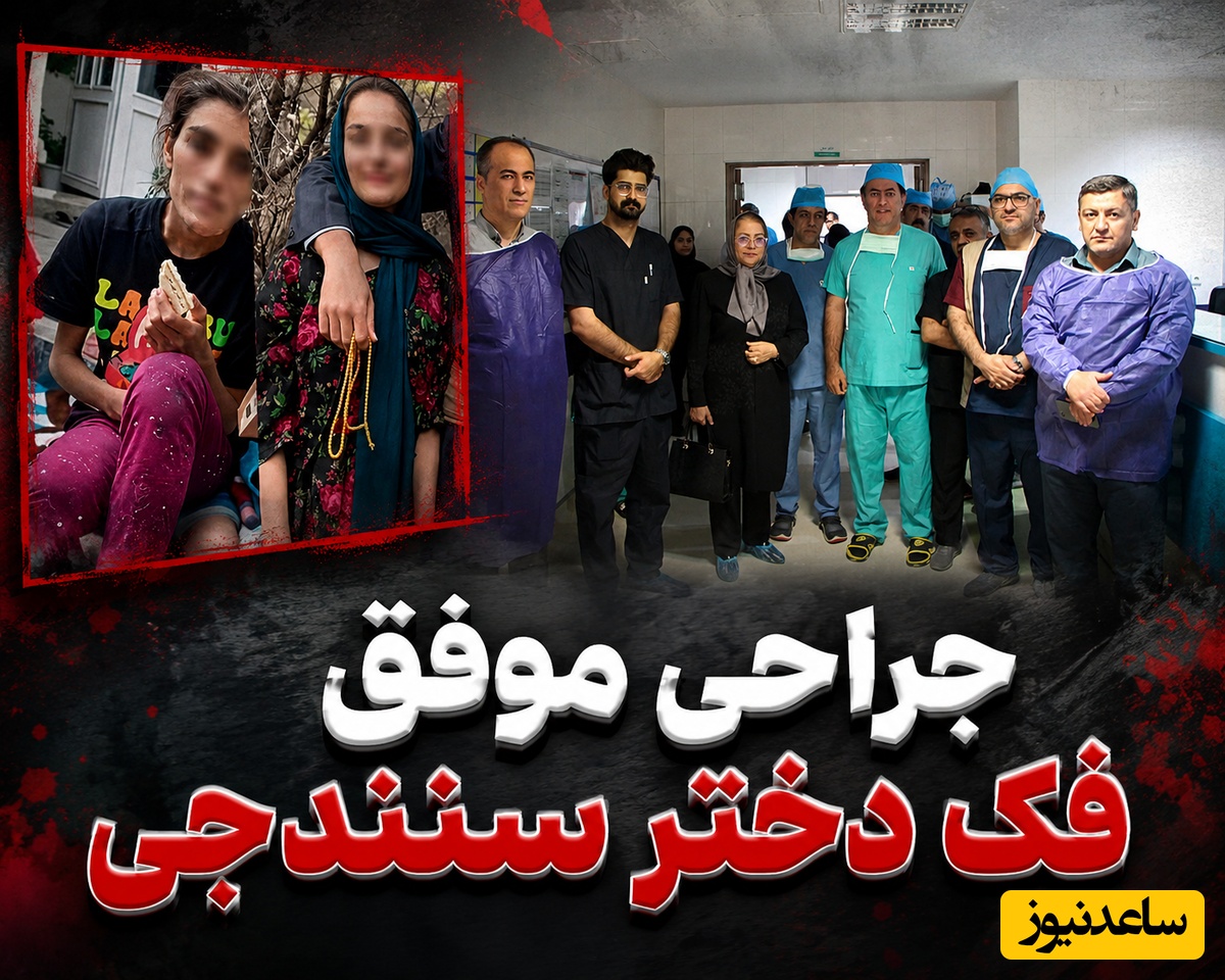 فیلم| جراحی موفق فک نارین، دختر 15 ساله سنندجی که دنیای کودکی‌اش زیر سایه لگدهای پدر زخمی شد