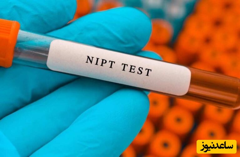 (آمنیوسنتز و NIPT)