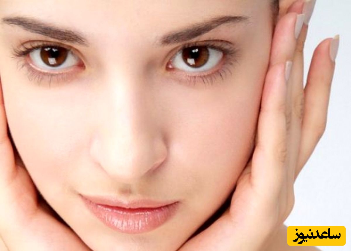 با یخ‌های شیری جای جوش را درمان کنید!