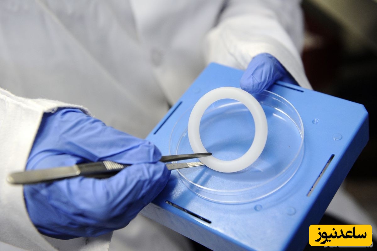 پساری یا رحم‌بند چیست و چه کاربردی دارد؟