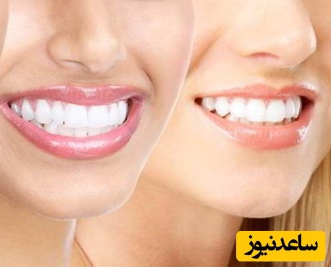 5 راه جادویی برای عفونت دندان