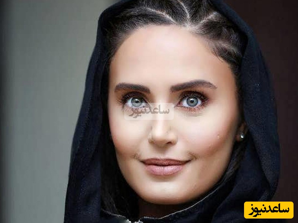 تغییر چهره باورنکردنی الناز شاکردوست بازیگر چشم رنگی ؛ خانم بازیگر رو اصلا نمیشه شناخت