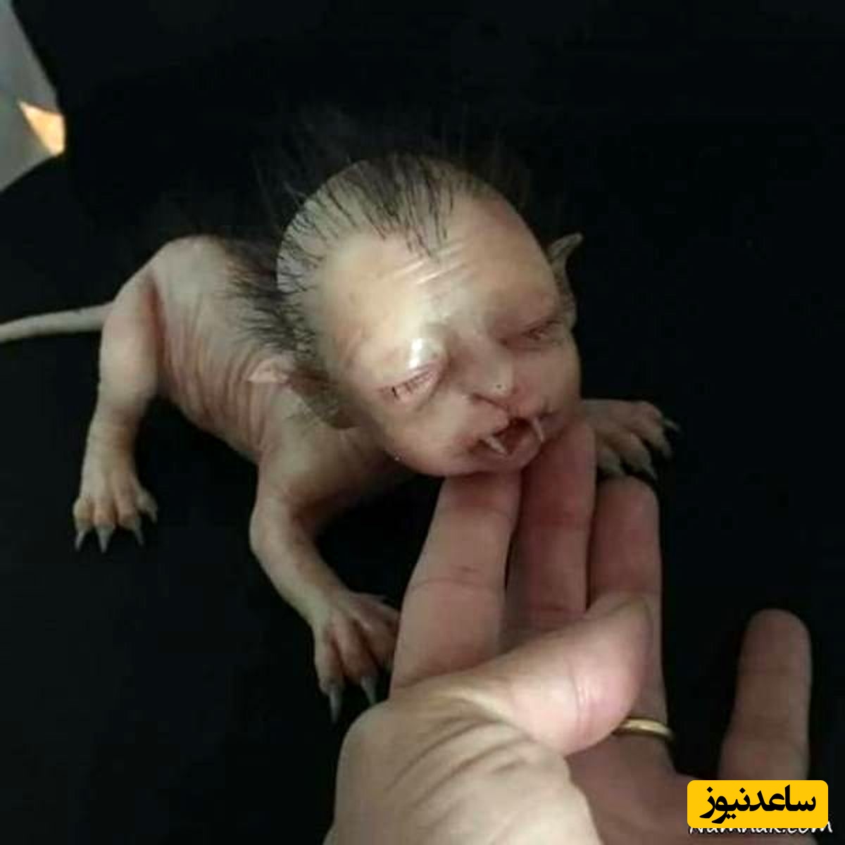 تولد نوزاد 4 پای عجیب الخلقه نیمه انسان و نیمه حیوان! از حکمت خدا نمیشه ساده رد شد!