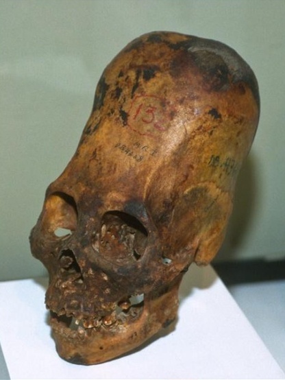 جمجمه کشیده