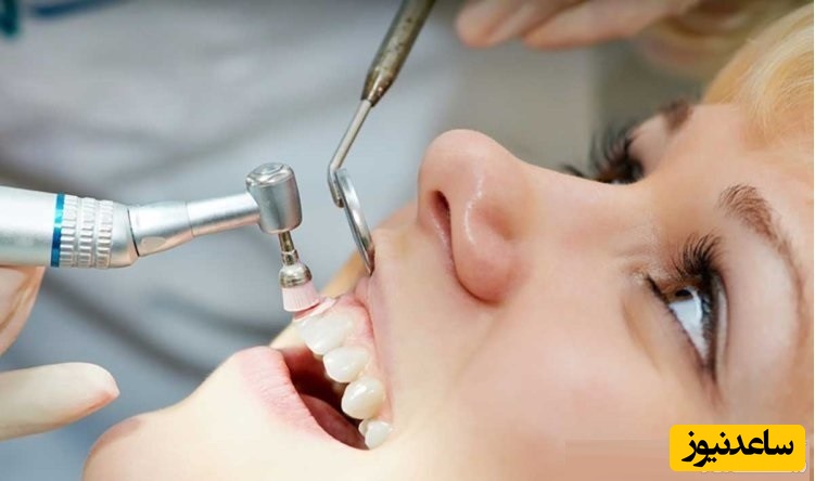 جرم گیری دندان و سلامت و بهداشت