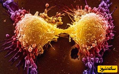 طراحی سیستم کلینیکی تشخیص سریع متاستاز در دانشگاه تهران