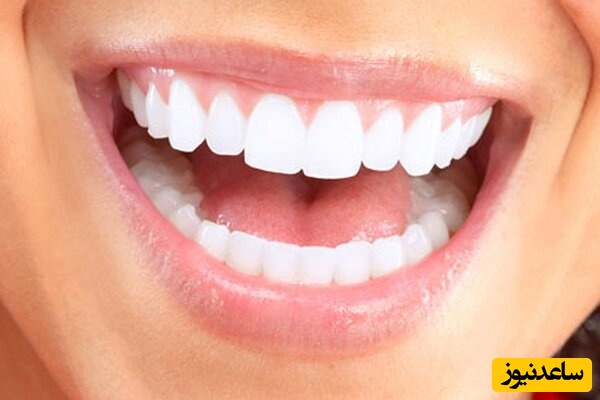 درباره "بروساژ دندان" چه می دانید؟