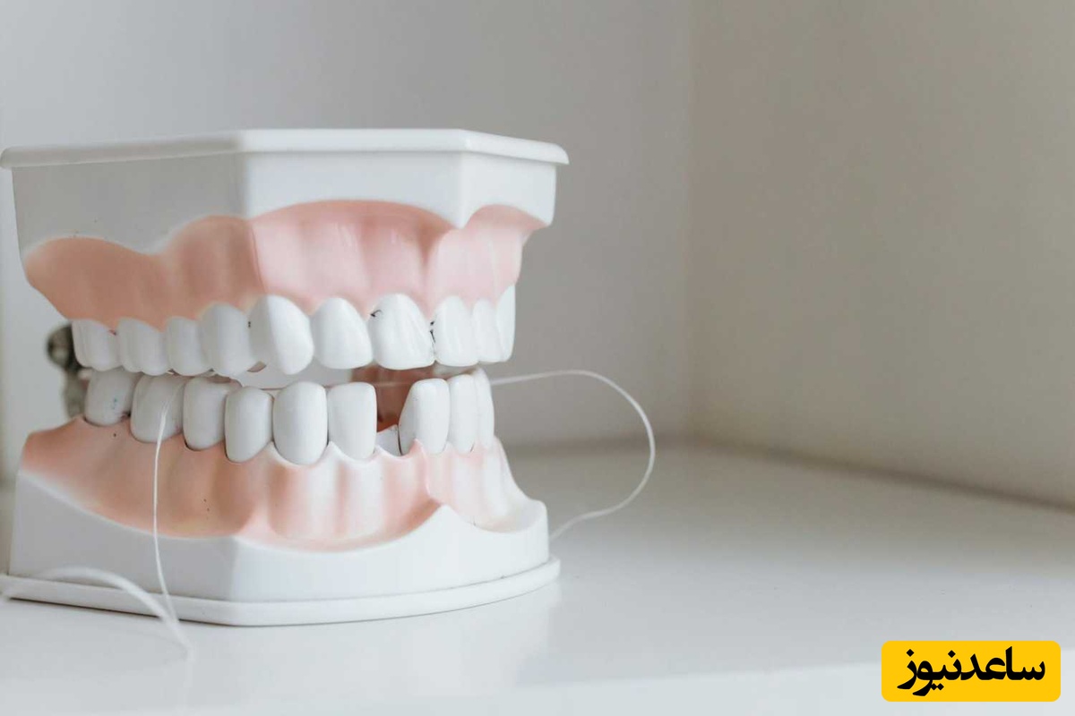 سوالات متداول در مورد انتخاب نوع ایمپلنت دندان