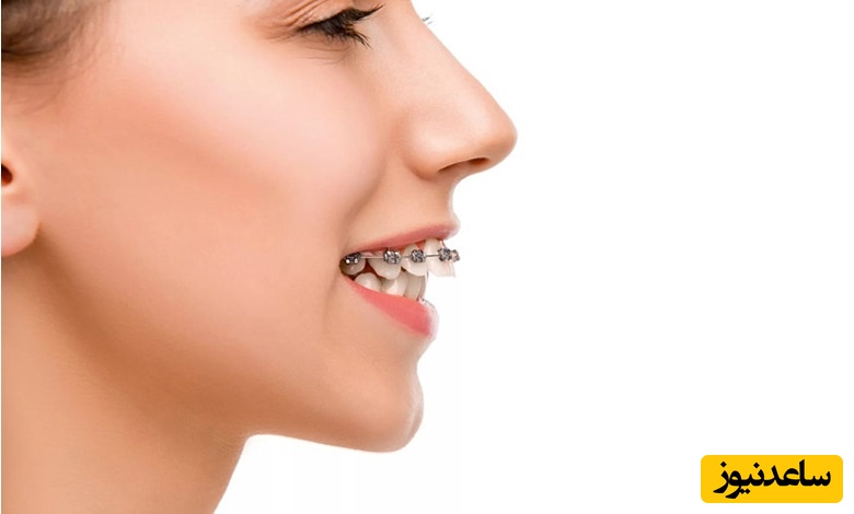 روش‌های درمانی برای اورجت