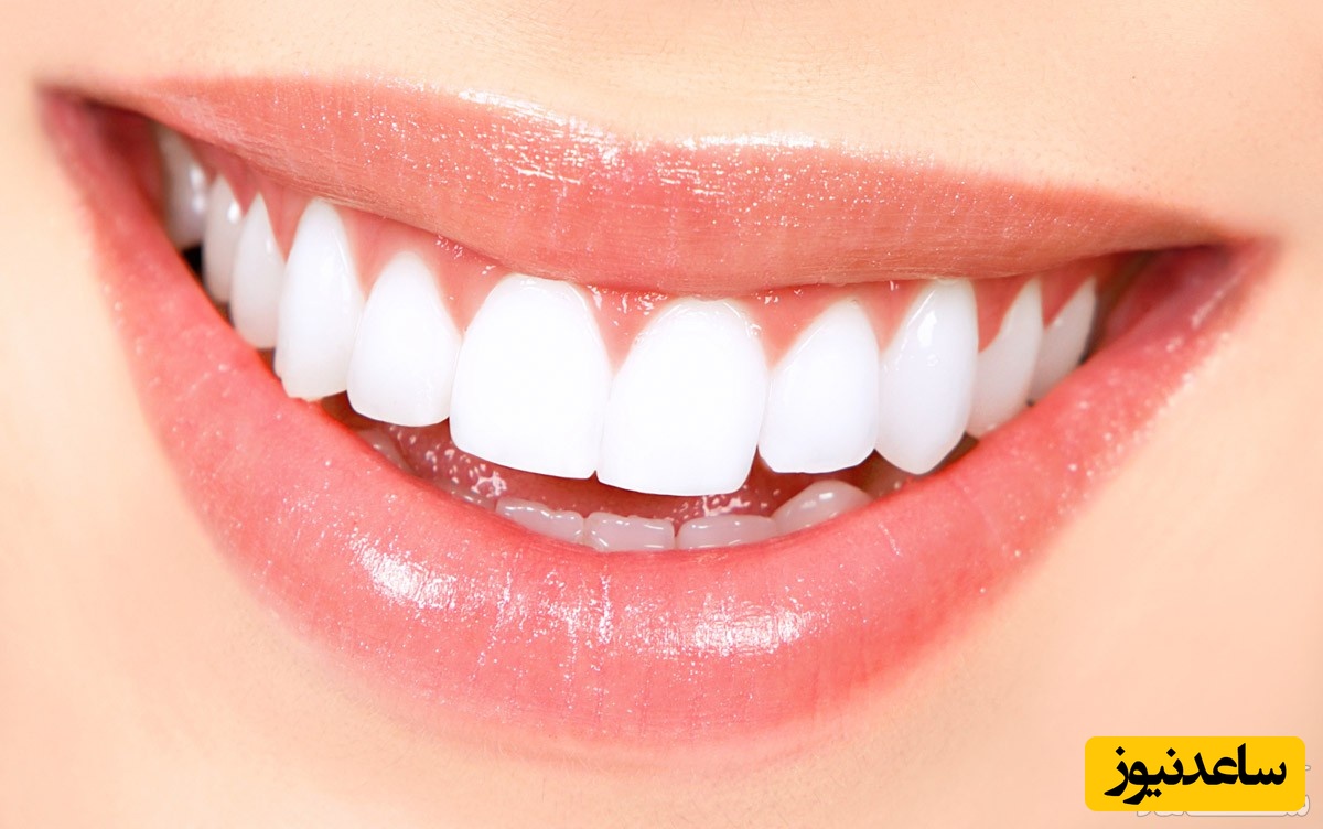 اسامی 32 دندان انسان