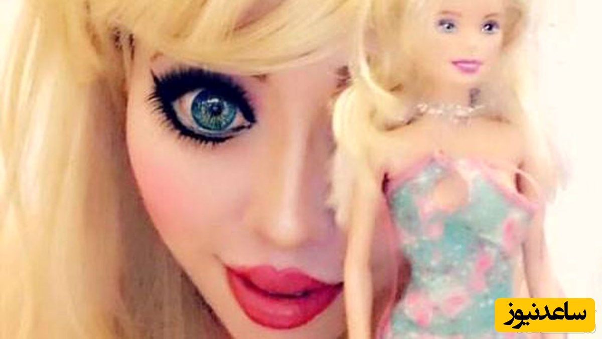 جراحی دختر 30ساله با هزینه 200 میلیون برای شبیه شدن به عروسک باربی!