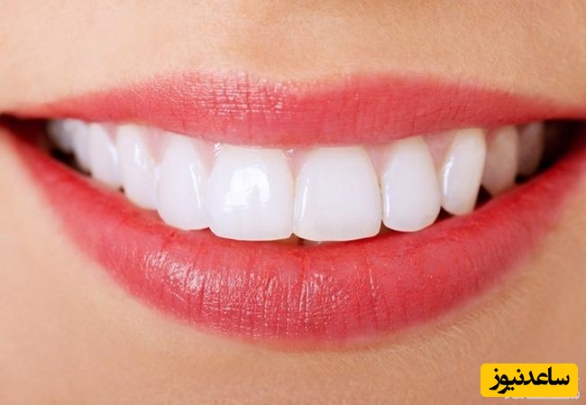 بهترین روش مسواك زدن كدام است؟