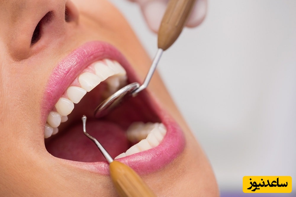 چگونه عفونت ایمپلنت دندان را تشخیص دهیم؟