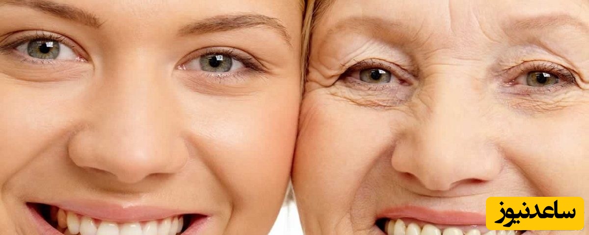 دندان مصنوعی انعطاف پذیر چیست؟