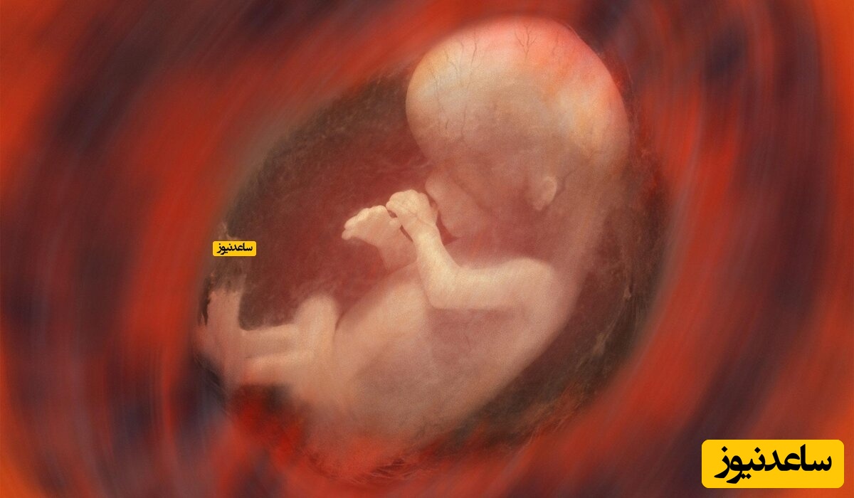 علائم کیست کورپوس لوتئوم در بارداری