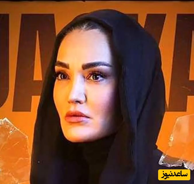 سولماز حسینی بازیگر سریال شغال :بهم میگن صورت عملی زشت!