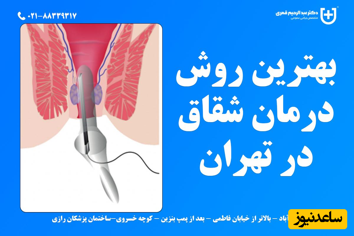 کلینیک لیزر شقاق در تهران