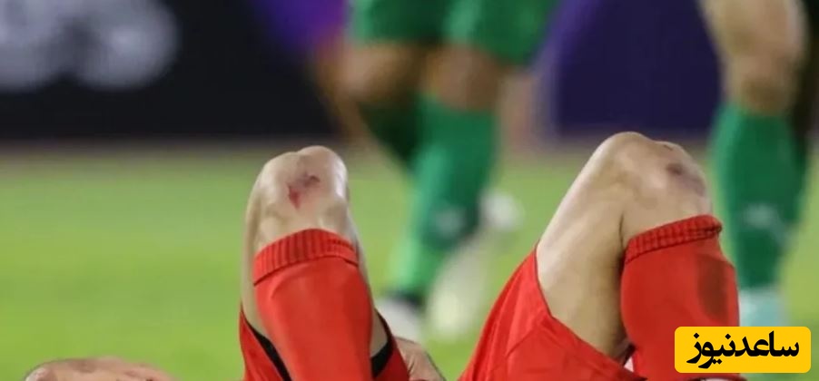 شجاع خلیل زاده: من شلوارم رو بدم بالا تمام زانوهام زخمه زمین انگار آسفالت بود، پای آبروی ایران درمیونه خجالت نمیکشین واقعاً+فیلم