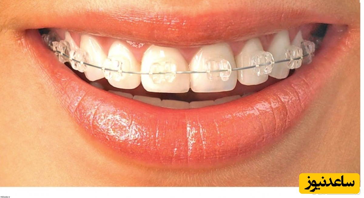 موارد اورژانس ارتودنسی کدام هستند؟