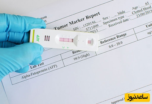 آزمایش بتا در بارداری چیست؟ | زمان دقیق انجام، تفسیر نتایج و اهمیت آن برای تشخیص حاملگی