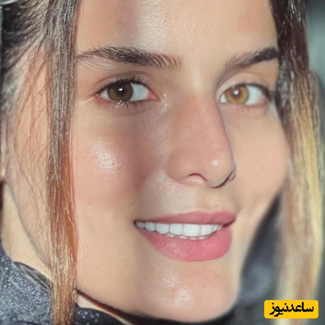 غزاله اکرمی