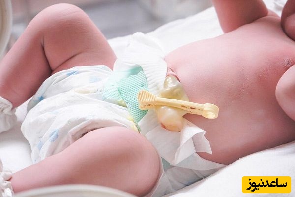 چرا ناف کودک درد می‌گیرد؟ | بررسی علل و درمان خانگی و پزشکی درد ناف بچه‌ها