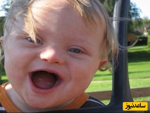 عقب ماندگان ذهنی