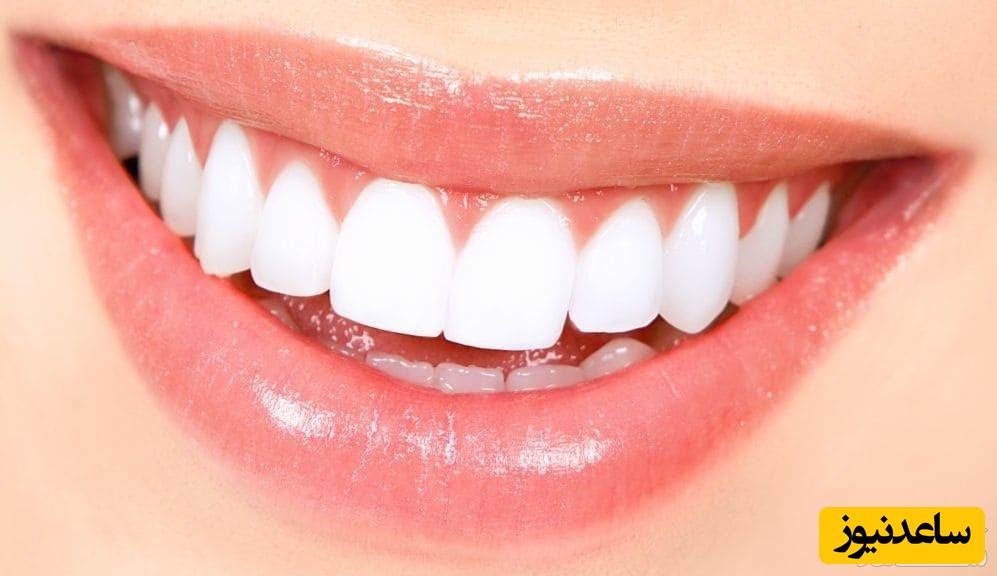 پلاک دندان چیست؟