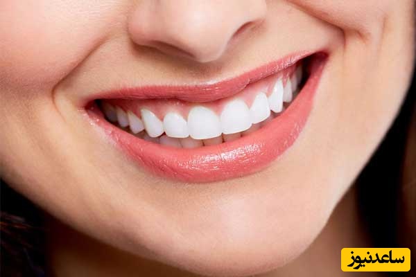 کدام عوامل در زیبایی لبخند موثر است؟
