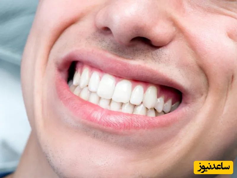 مسواک بین دندانی چه نوع مسواکی است ؟