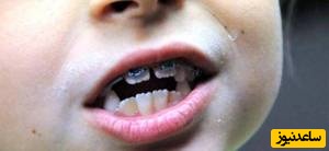 اپن بایت و بلند بودن صورت!