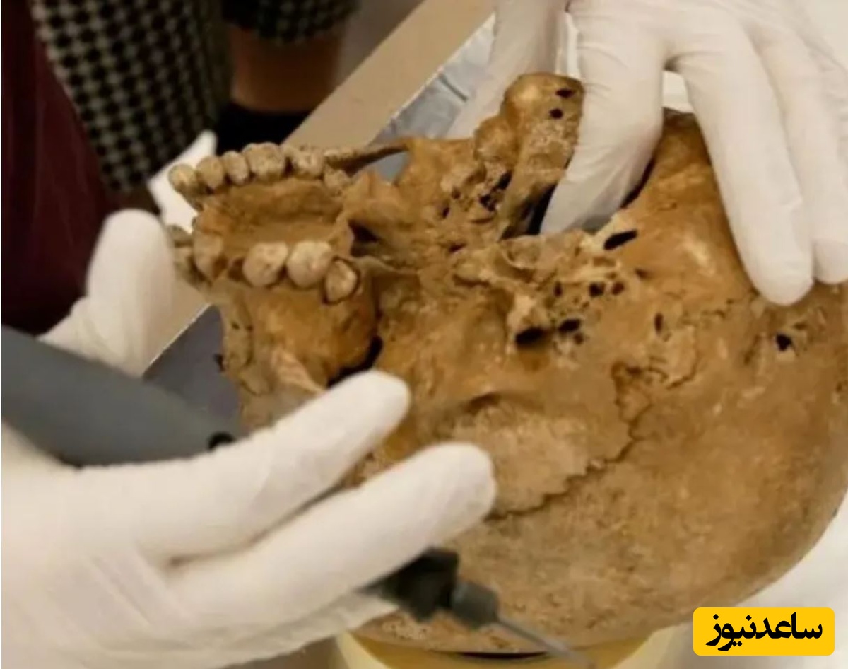 پژوهشگران با استفاده از تحلیل دیاِناِی، نوع نادری از کوتولگی را در اسکلت متعلق به عصر سنگ شناسایی کردند