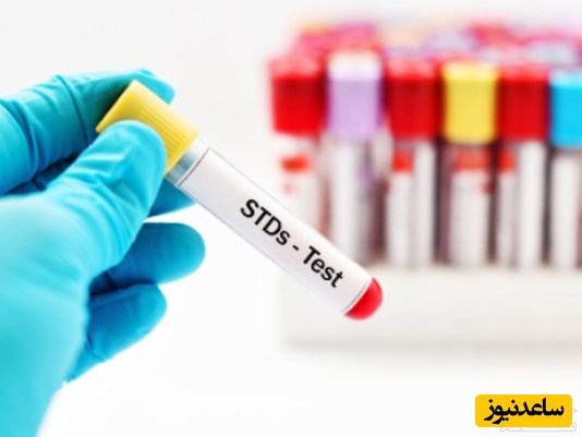 آشنایی با خطرناک‌ترین بیماری‌های جنسی