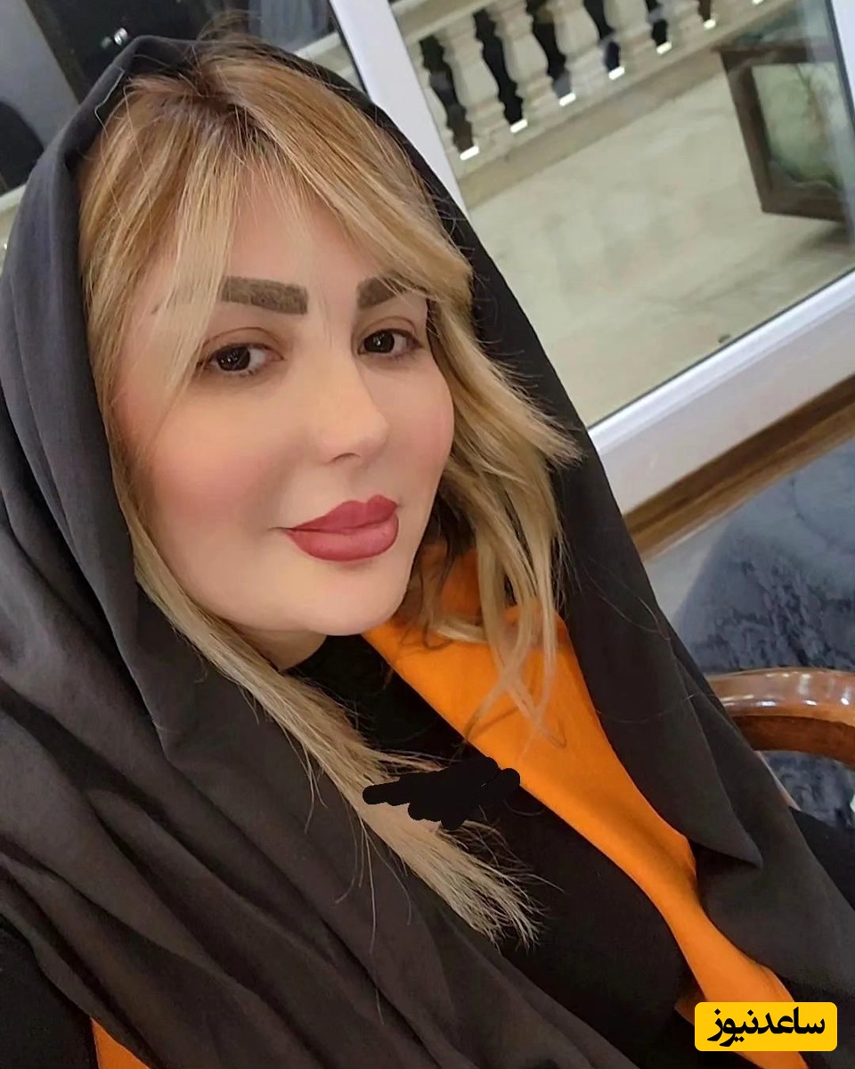 تصویر لورفته از صورت زخم و کبود نیوشا ضیغمی در پشت صحنه یک فیلم! ماجرا چیست؟!