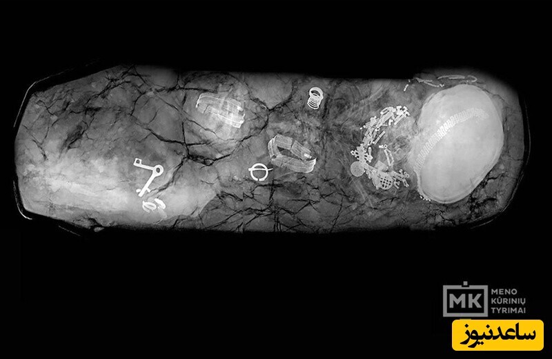 اشعه ایکس زینت‌های این زن 600ساله را نشان می‌دهد. سر تاج دار او سمت راست تصویر است.  